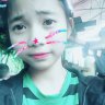 Other_Rins